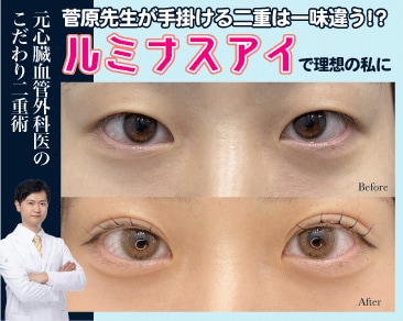 【二重埋没の名医】目元整形といえば菅原院長がおすすめ（イオン横浜西口院）