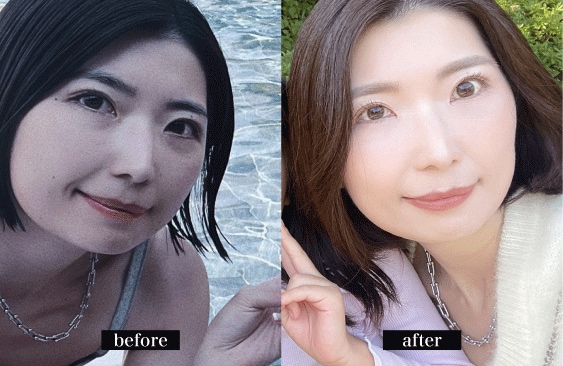 手術後の変化