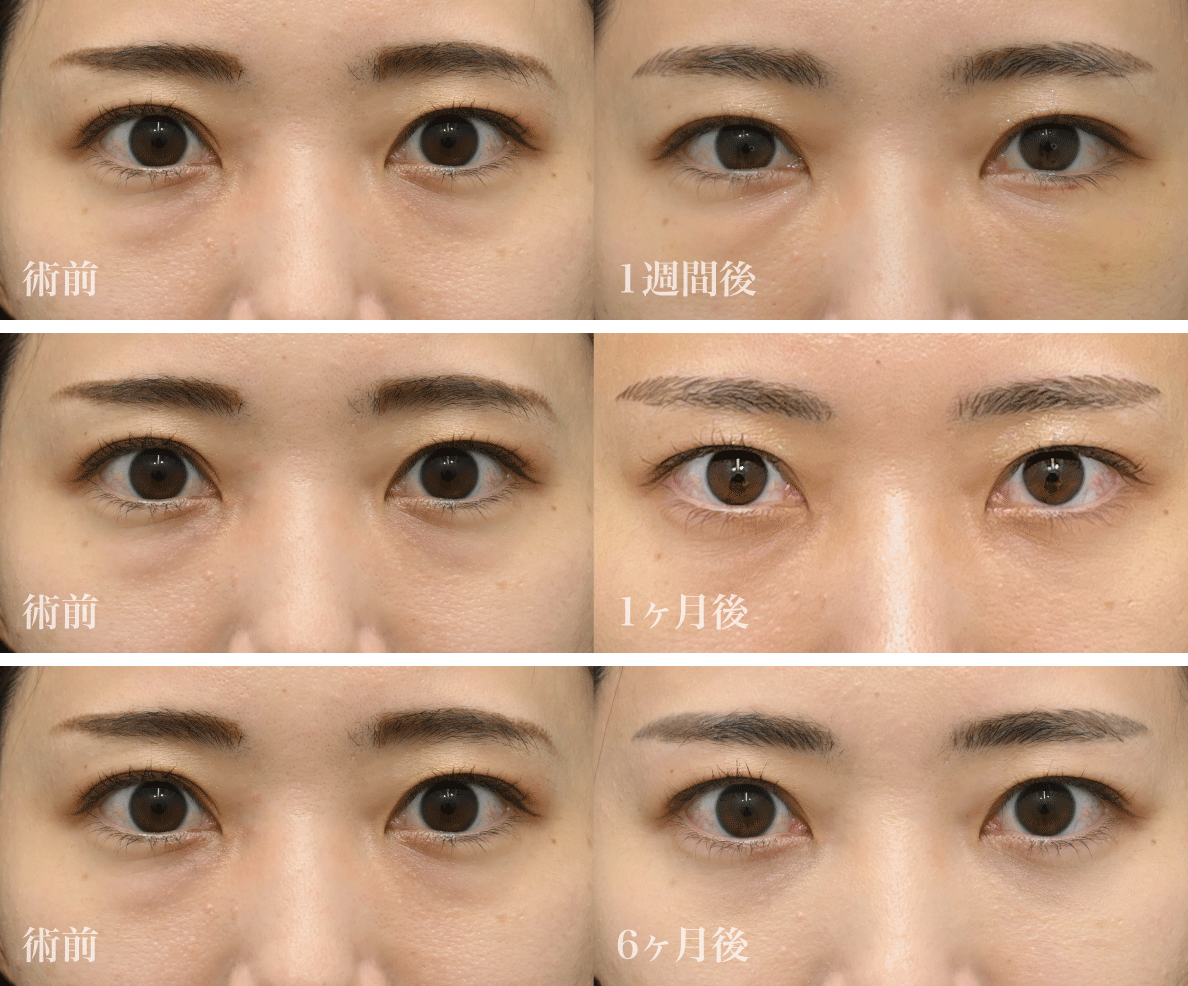 まずは美しすぎる<br />
Before／After