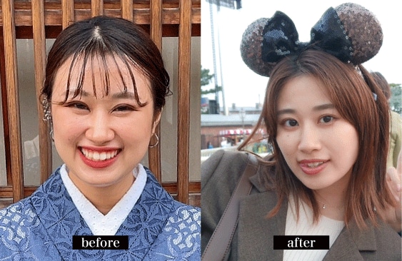 手術後の変化