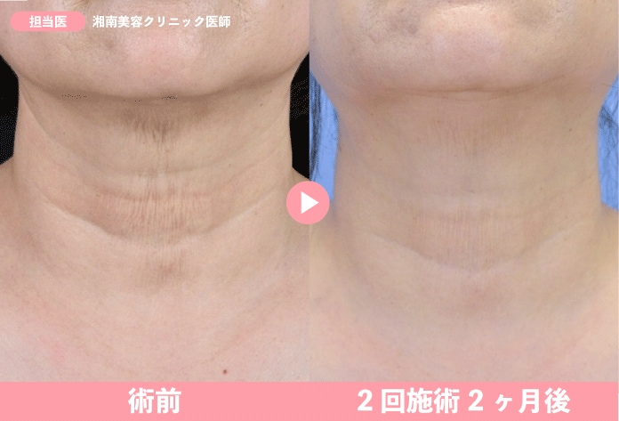 首