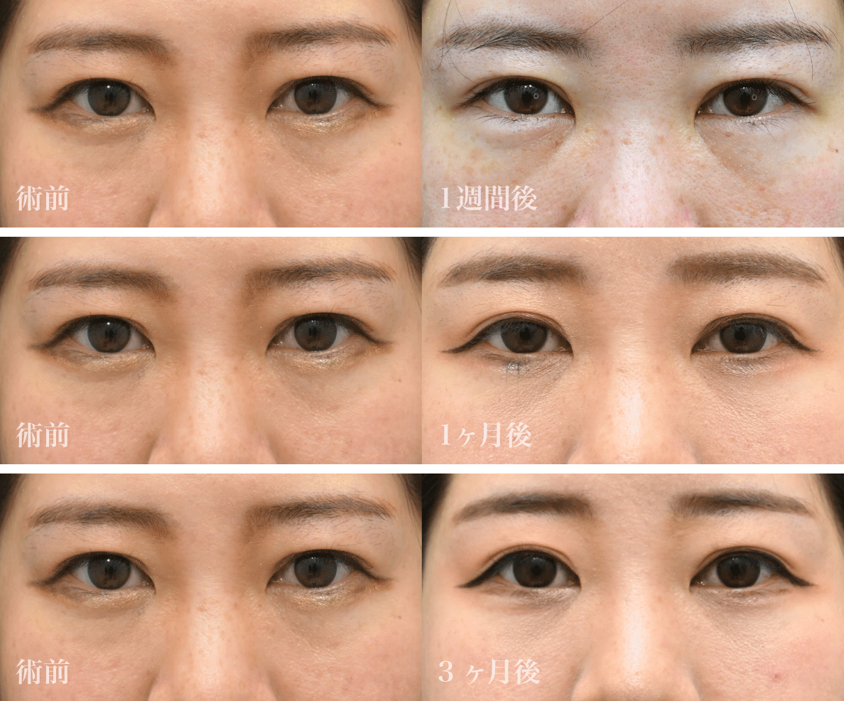 まずは美しすぎる<br />
Before／After