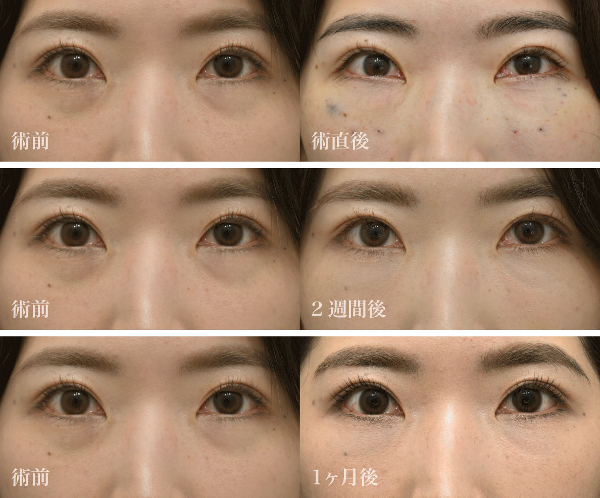 まずは美しすぎる<br />
Before／After
