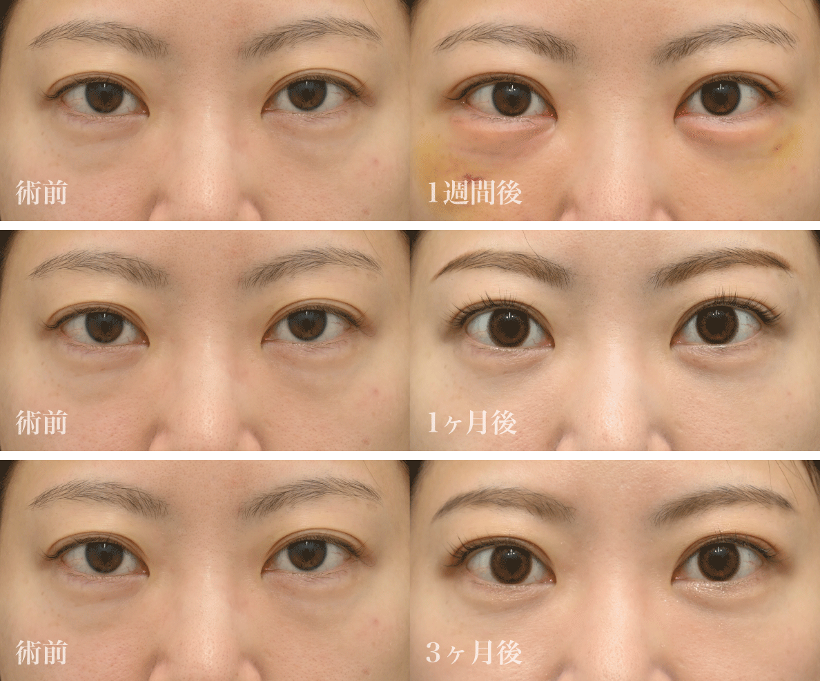 まずは美しすぎる<br />
Before／After