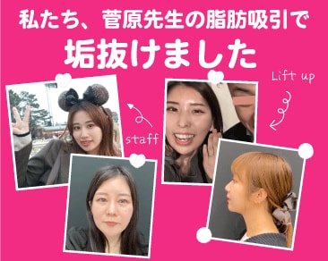 「私、脂肪吸引で変わりました！」菅原院長の脂肪吸引を受けたスタッフのリアルな体験談