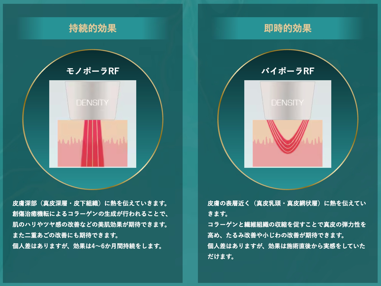 なぜデンシティは効果的？