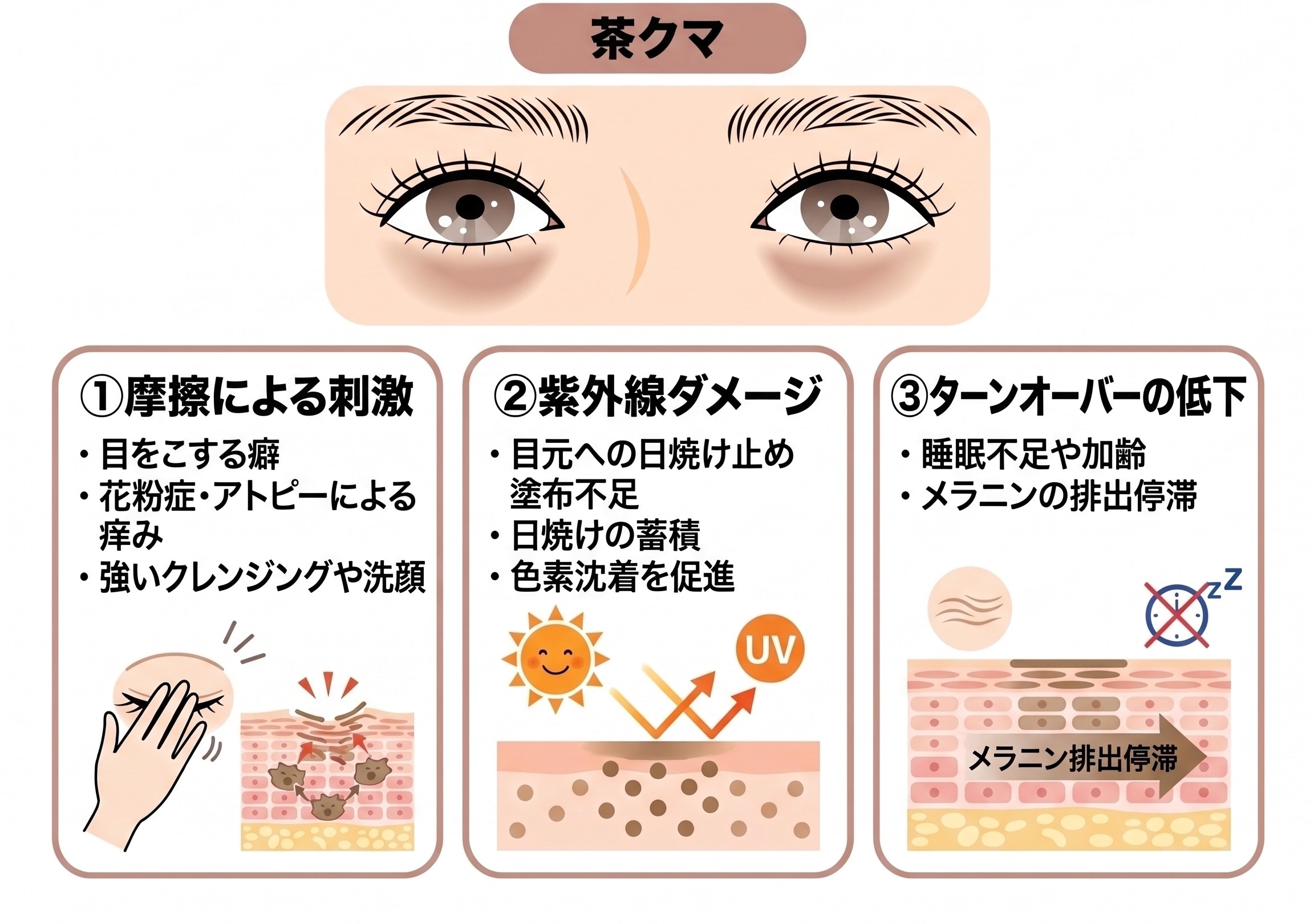 茶クマの原因と見分け方<br />
