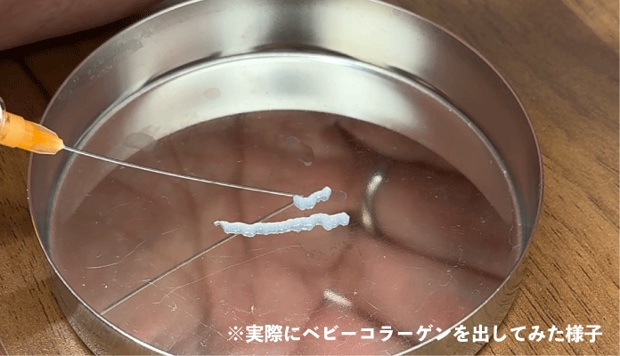 手術なしで目の下の<br />
小ジワや凹み、色味改善
