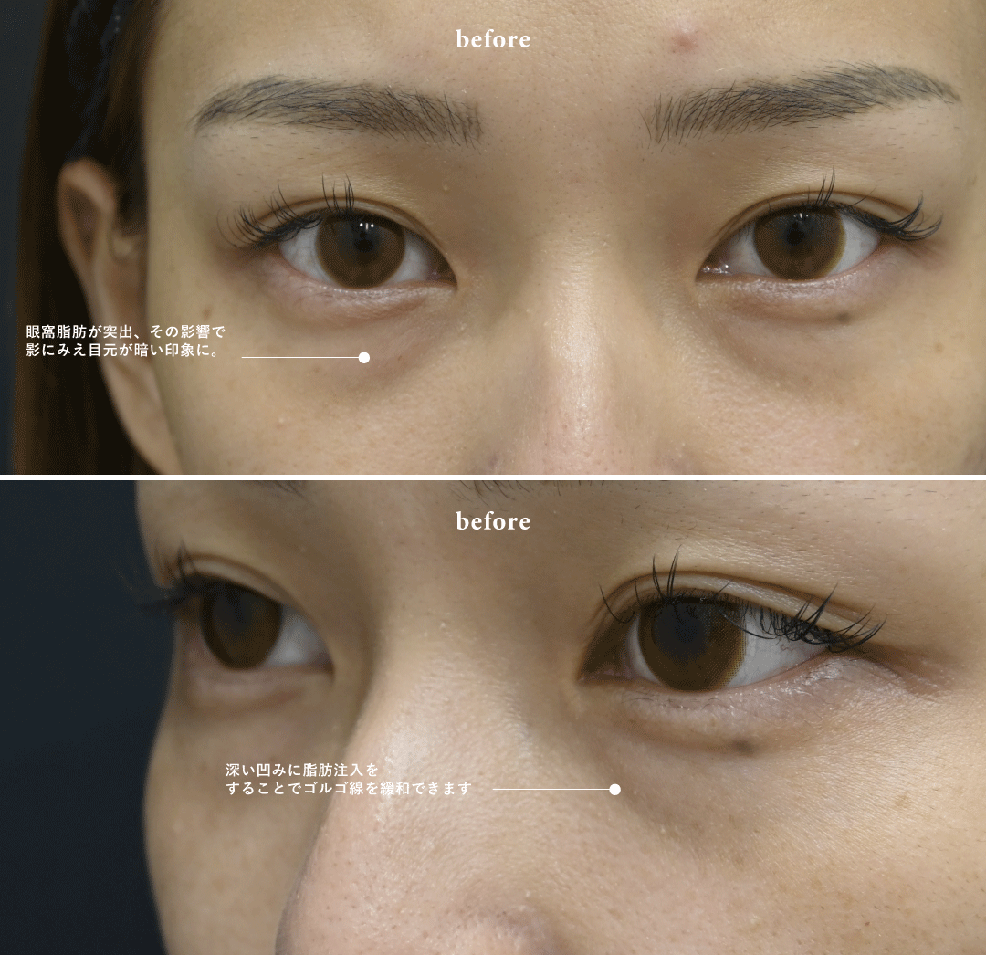 20代後半　実年齢より老けて見える