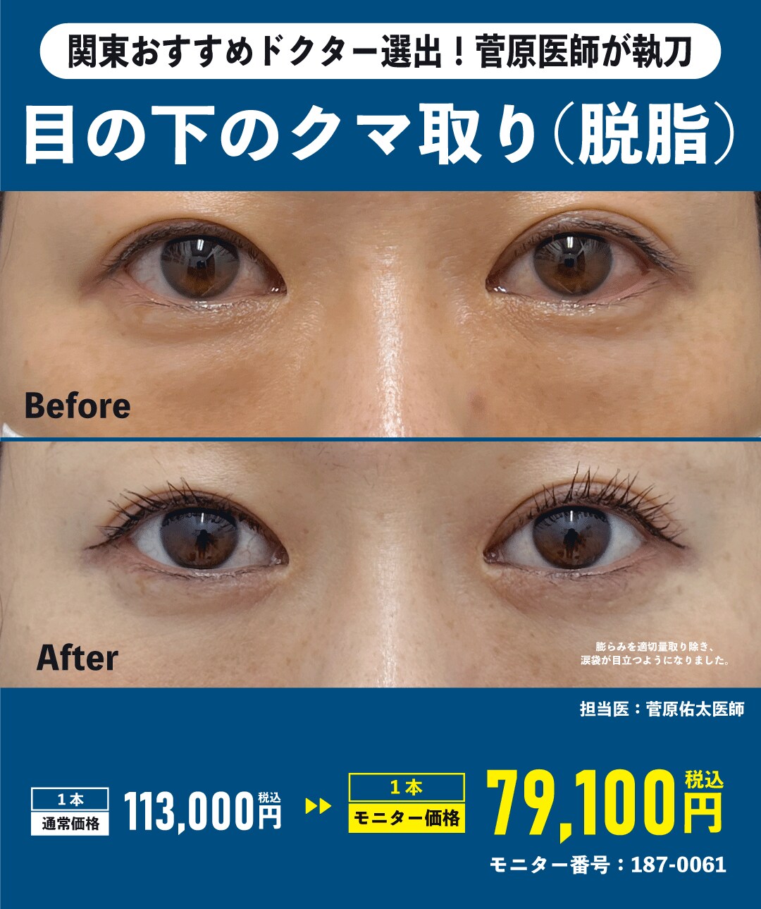 脱脂術＆裏ハムラがお得に🉐