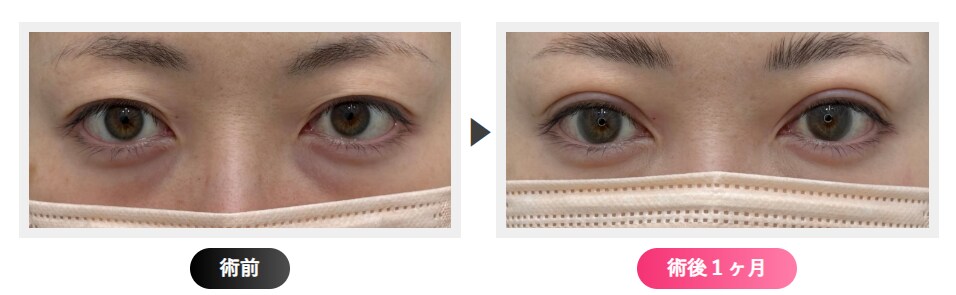 元心臓血管外科医の経歴を活かした技術力！