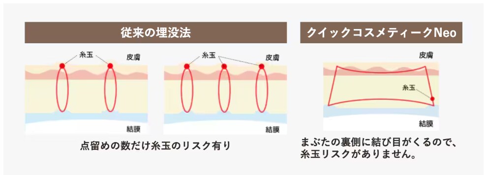 クイックコスメティーク・ダブルNeoとは？