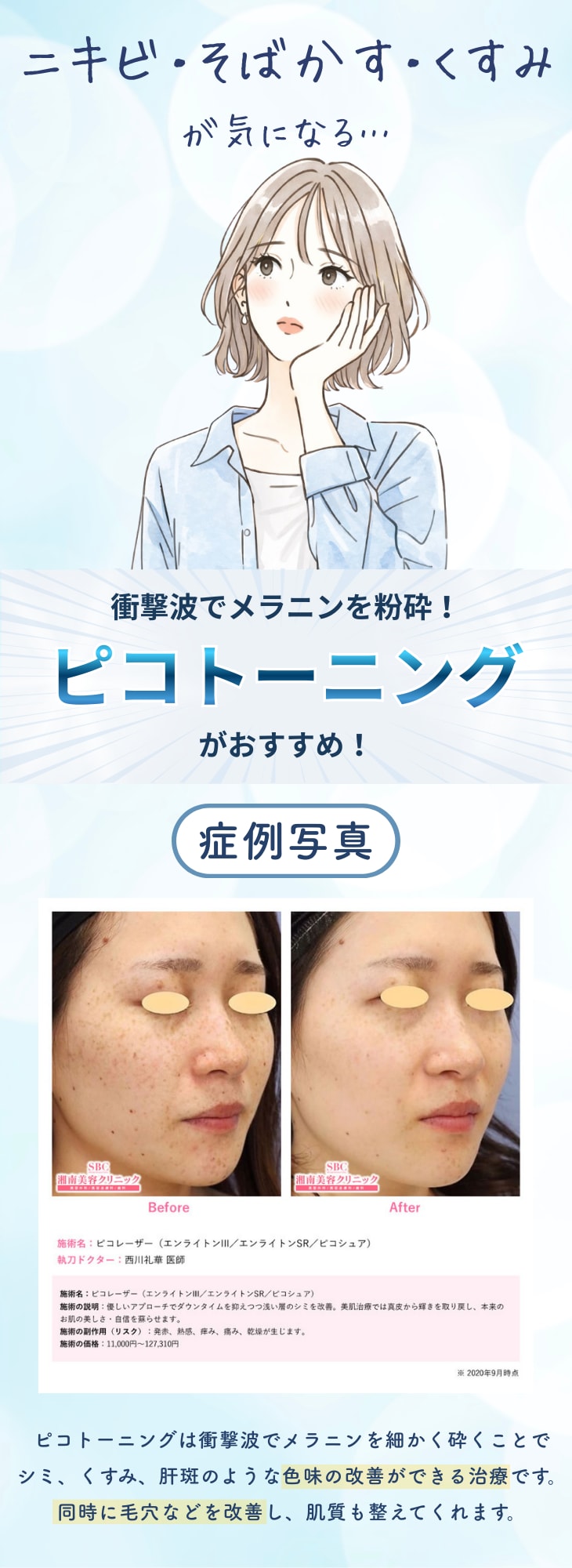 ピコトーニング