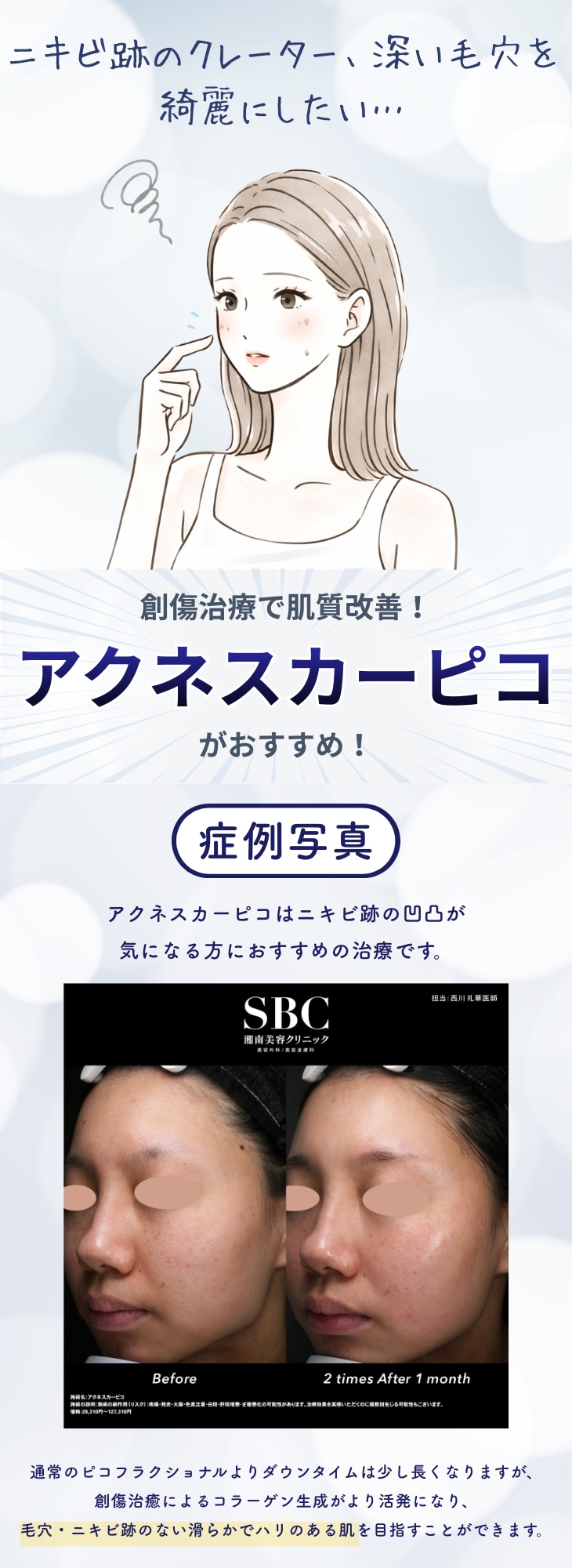 アクネスカーピコ