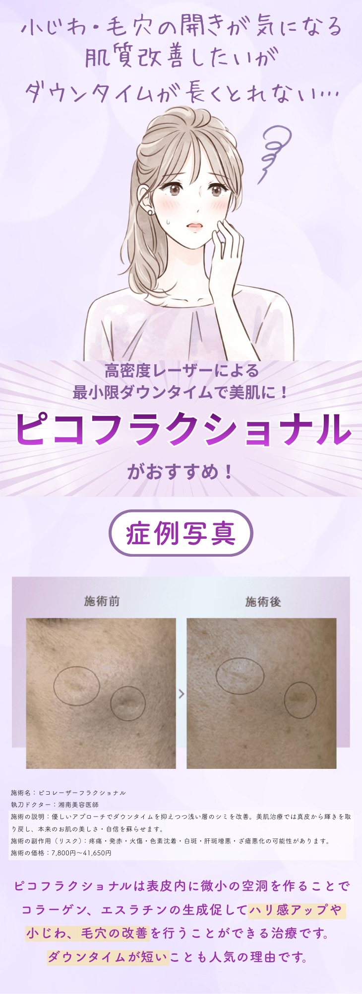 ピコフラクショナル