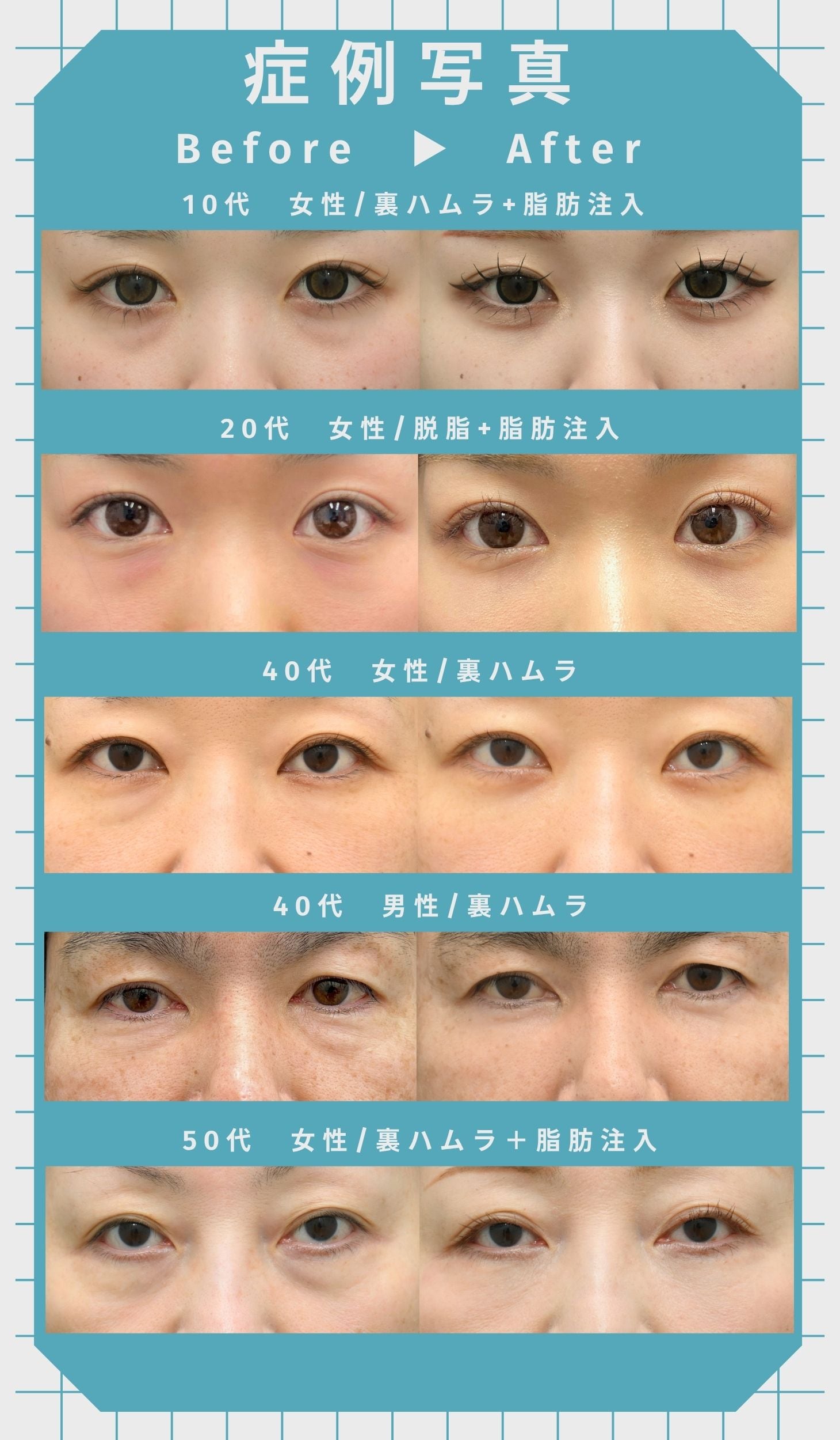 症例一覧