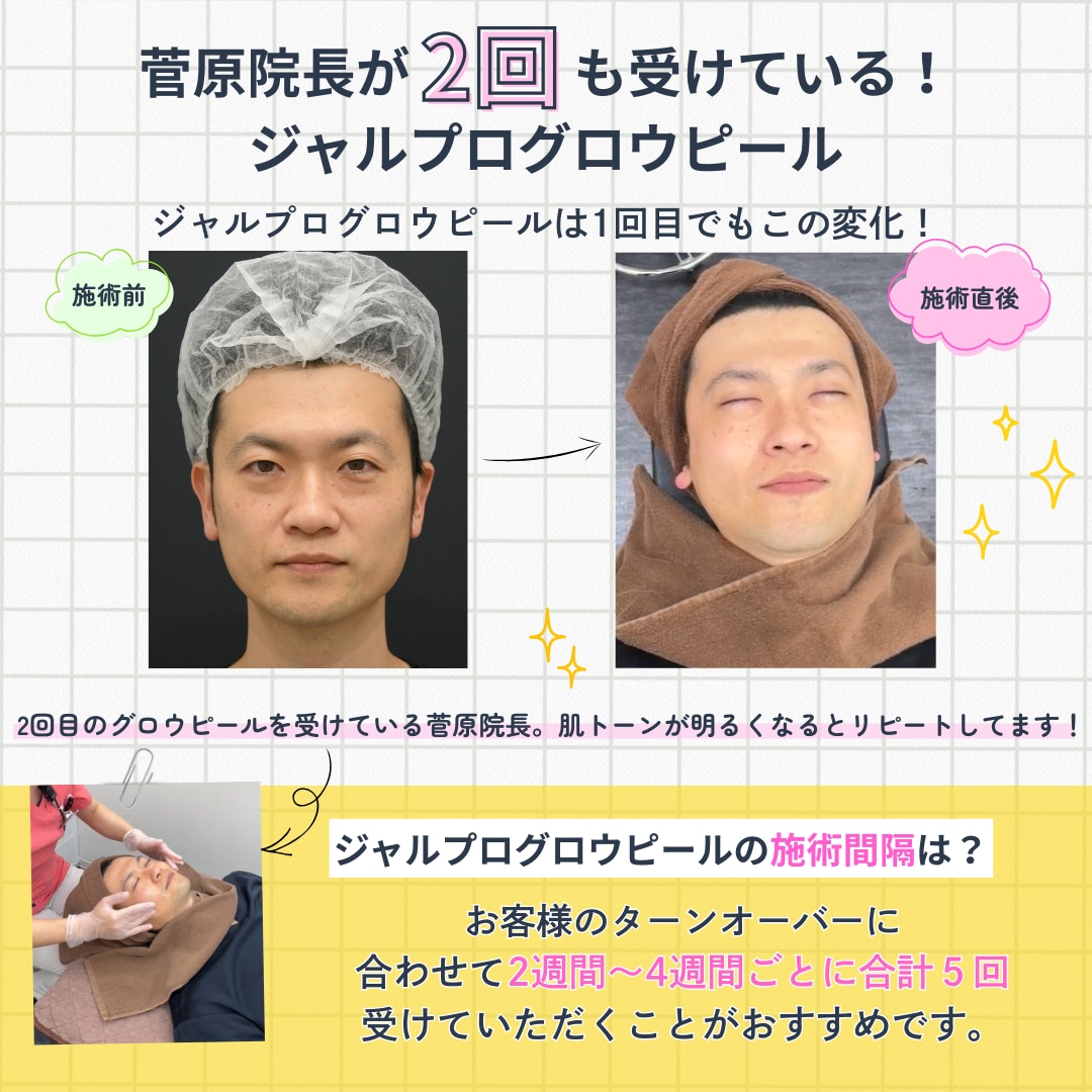 院長も認める実力！グロウピールの施術間隔は？