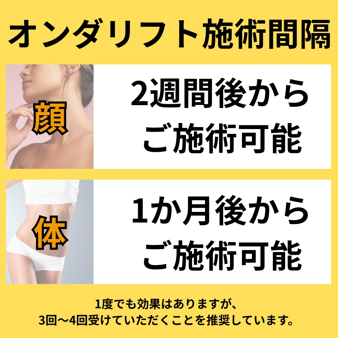 オンダリフトの施術間隔