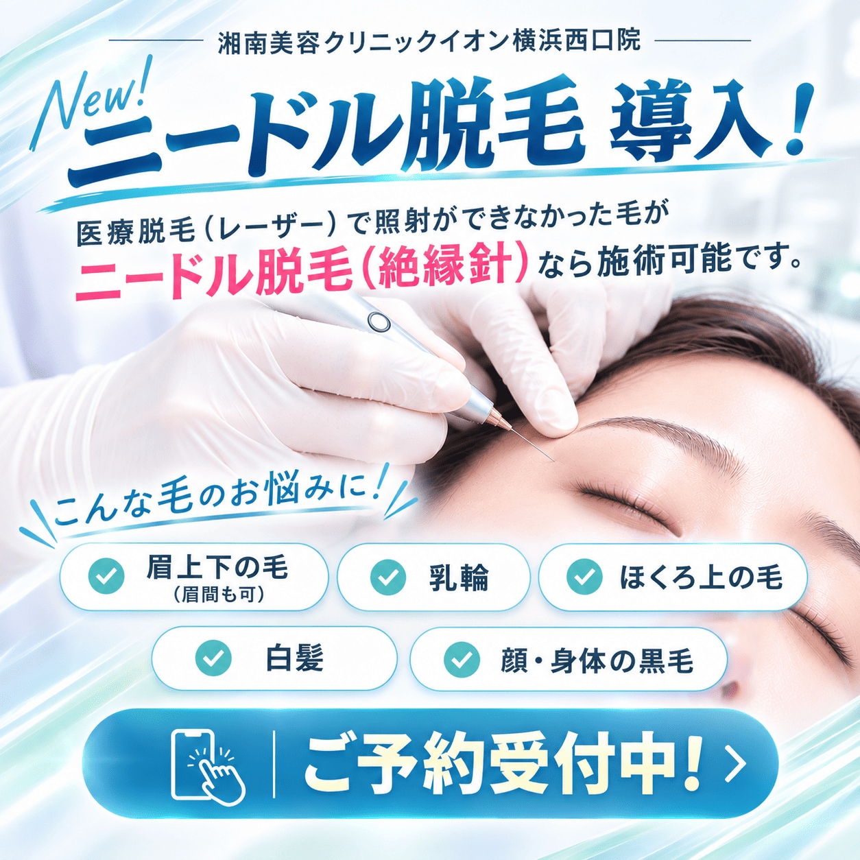 【眉毛・白髪も対応可】ニードル脱毛 イオン横浜西口院に導入！