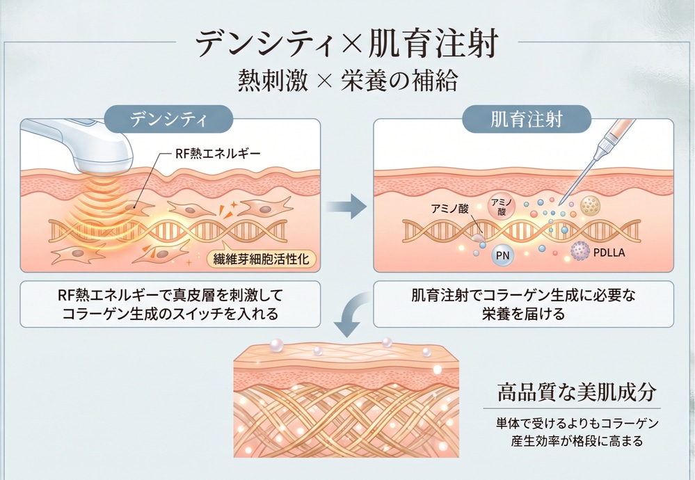 デンシティやレーザーと「肌育注射」を組み合わせる効果的な順番<br />
