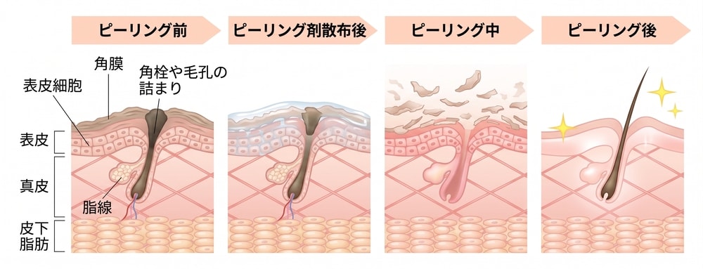 まずはピーリング・角質ケアで肌の土台を整える<br />
