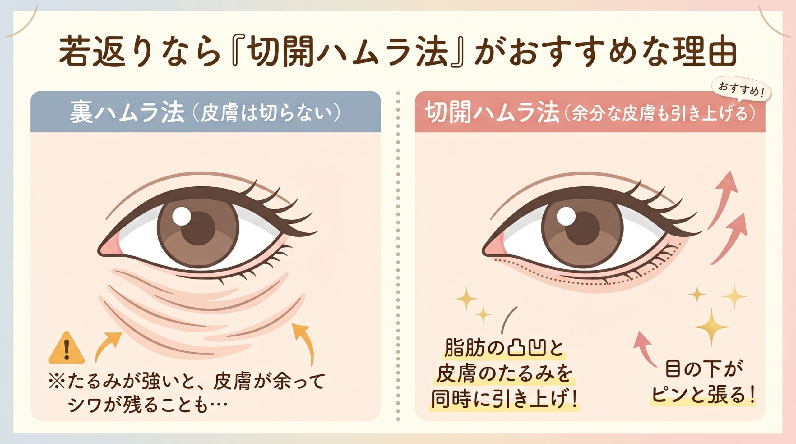 2. 目の下のたるみ・クマも同時に解消するなら「眉下切開 ＋ 切開ハムラ法」