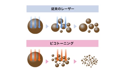 メラニンを破壊！シミ・くすみ撃退ならこれ！