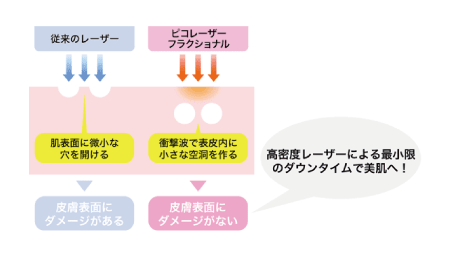 毛穴が気になる方はこれ！