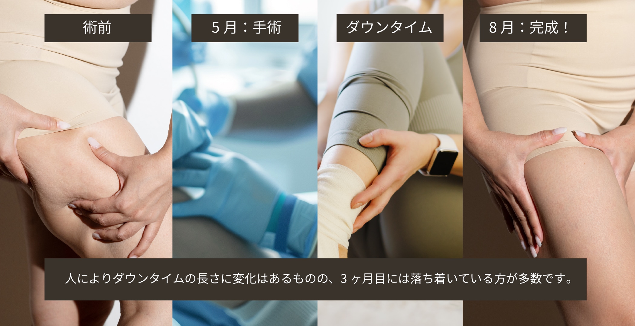 この時期脂肪吸引って人気なの？