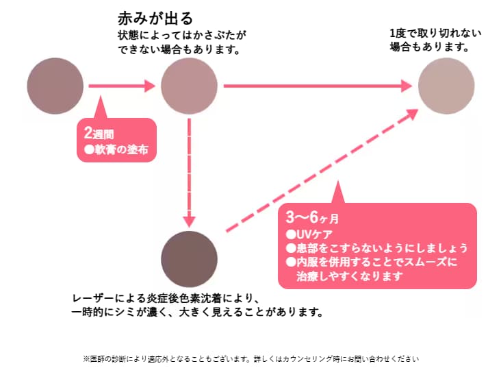 シミ取り後の経過