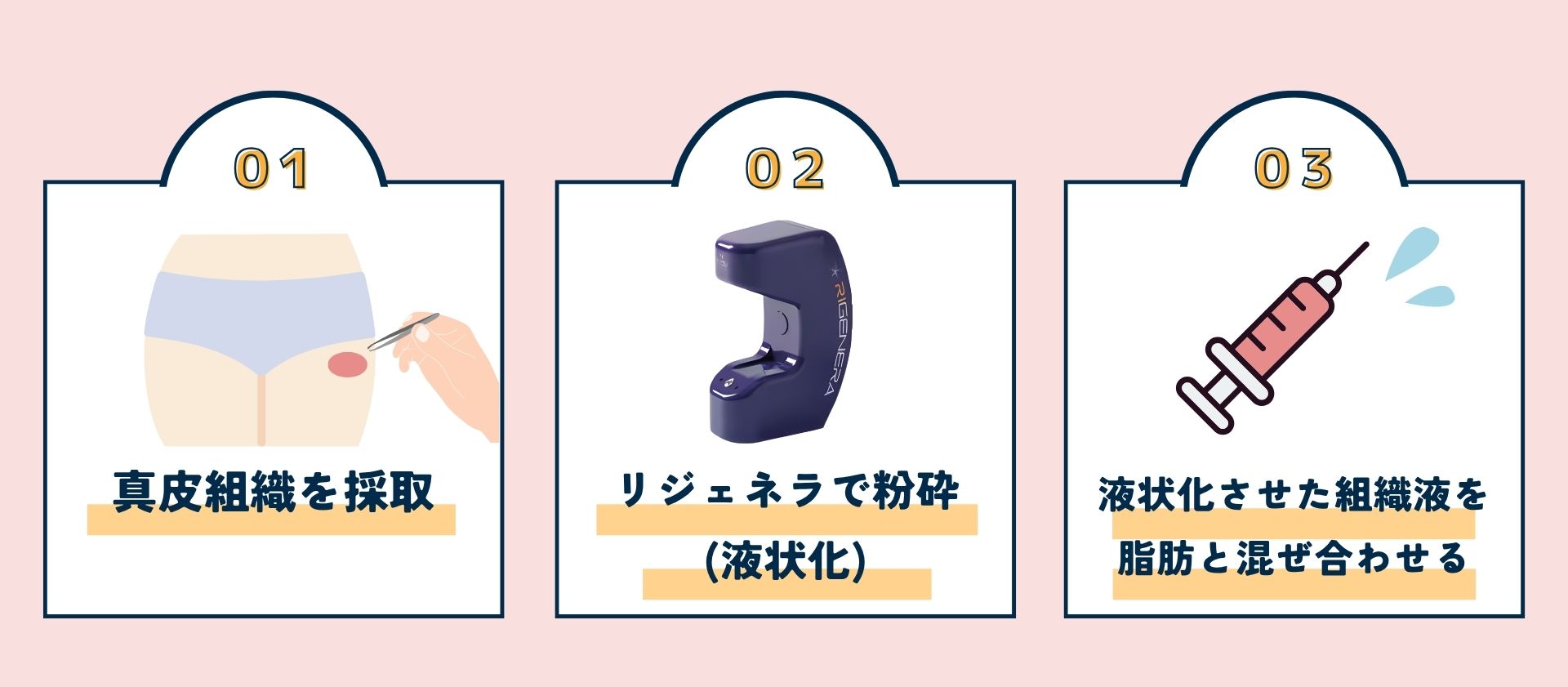 リジェネラとは?