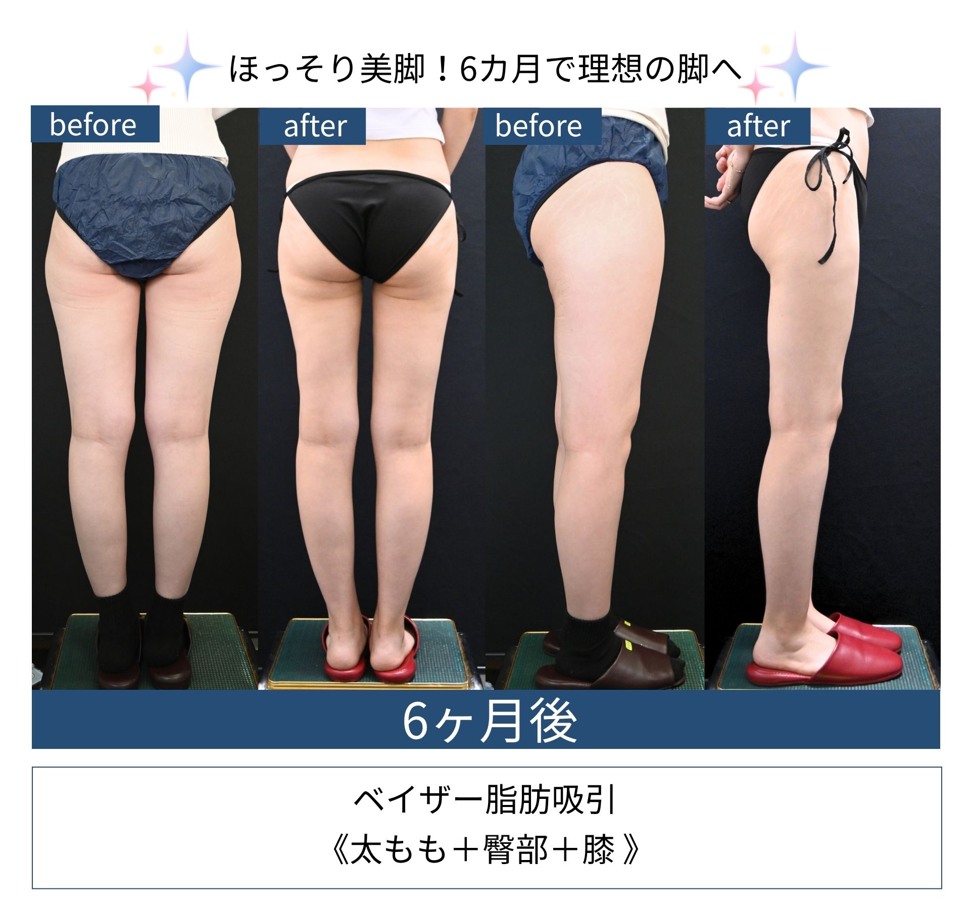 長谷川院長の症例写真