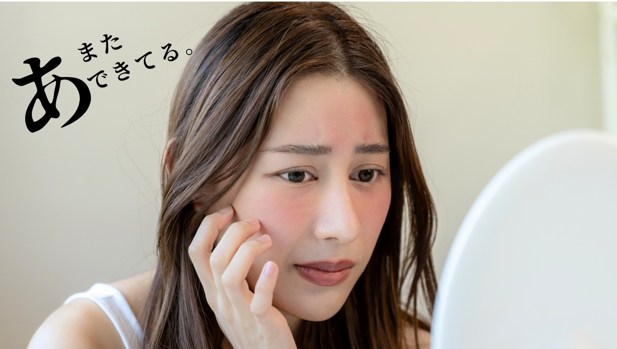 ～大事な予定の前に限って、できちゃうニキビ。どうしたらいいの？～<br />
「もうすぐイベントなのに…」と焦るほど、繰り返し現れるニキビ。<br />
それは肌表面だけの問題ではなく、皮脂腺や角質のターンオーバーの乱れが原因かもしれません。横浜院では、今ある炎症を鎮めつつ「ニキビができにくい肌質」へと根本から導きます。