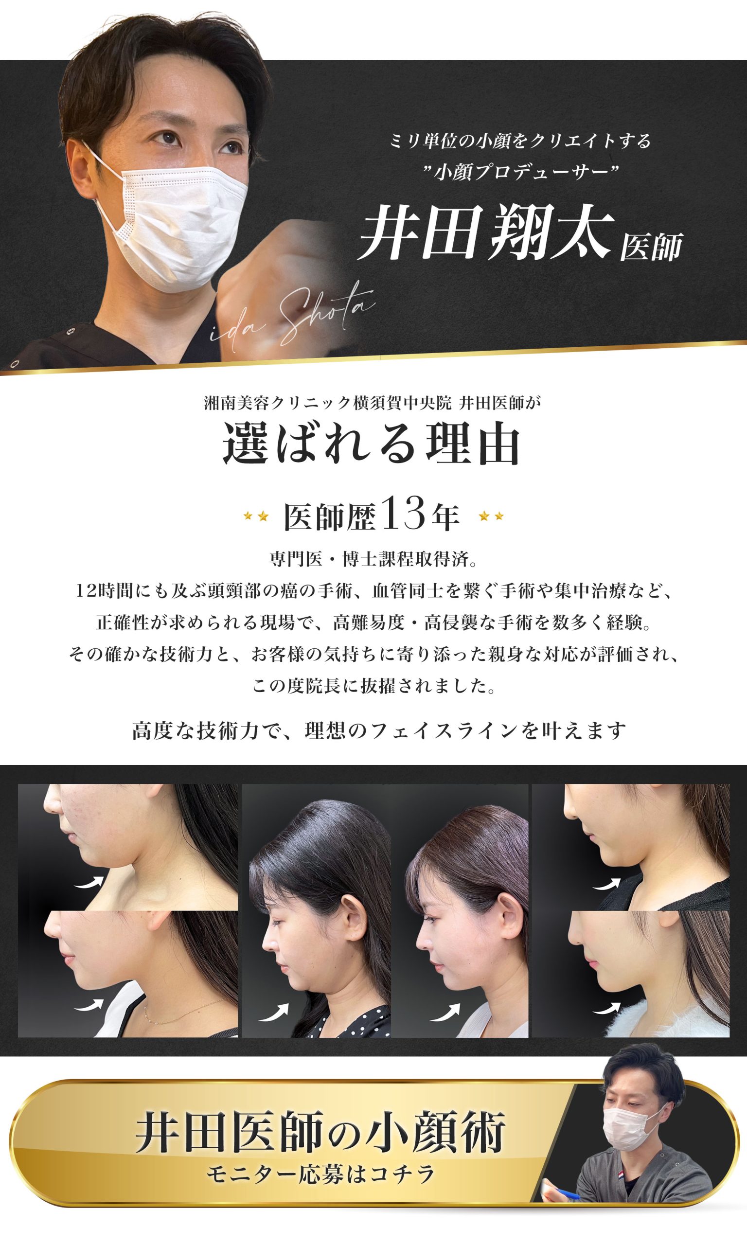 小顔術(脂肪吸引×糸リフト)は、横須賀中央院 新院長の井田翔太にお任せください！