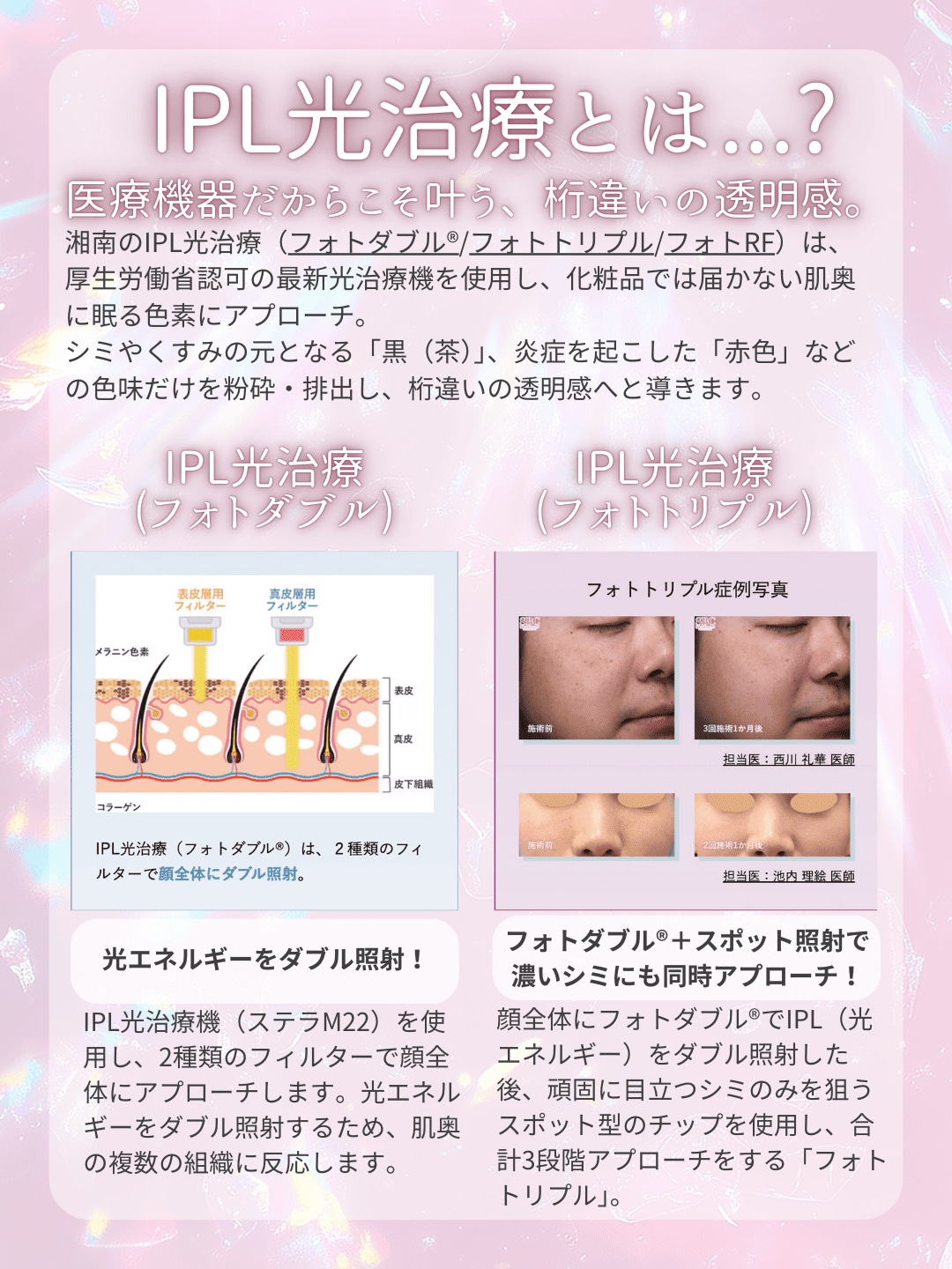 医療機関だからできる!桁違いの透明感「IPL光治療」とは?