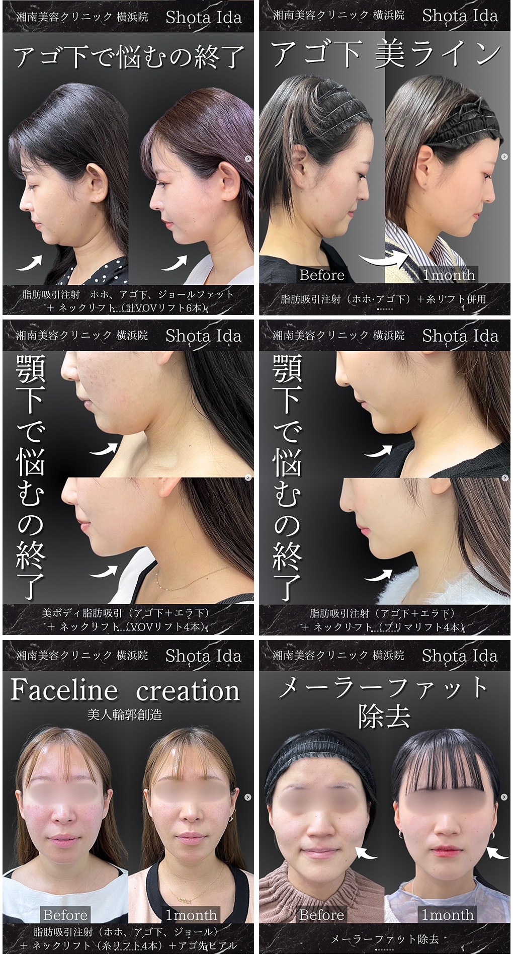 井田医師が執刀した症例写真です