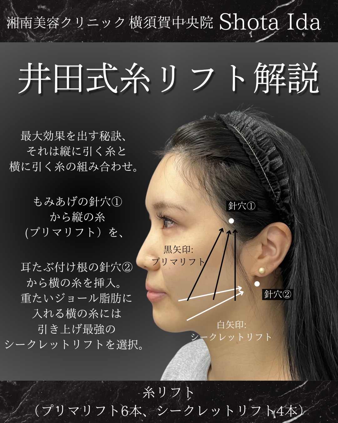 最大効果を出す秘訣
