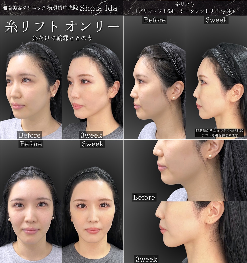 360度 どこから見ても美しい仕上がり