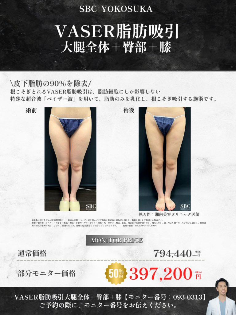 激安　脚痩せ・太もも痩せ　モニター募集