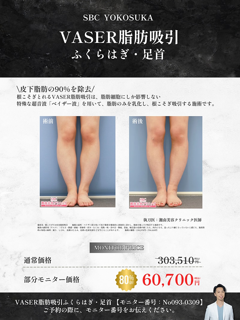 【8/17(日)限定】ふくらはぎ痩せが叶う‼️衝撃の80%OFF✨