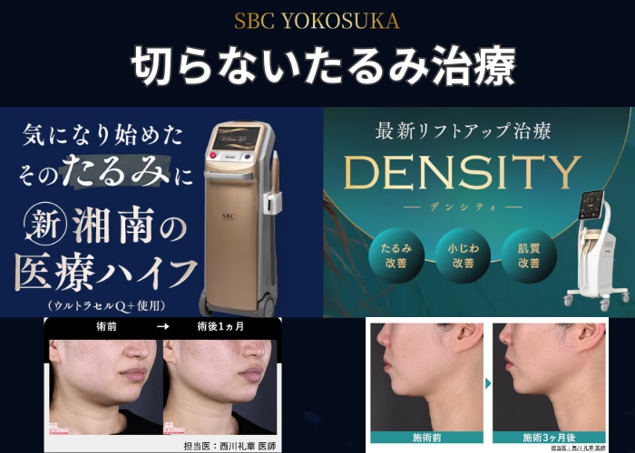 切らないたるみ治療部門🥇