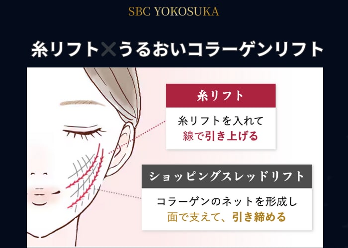 切らないリフトアップ部門🥇