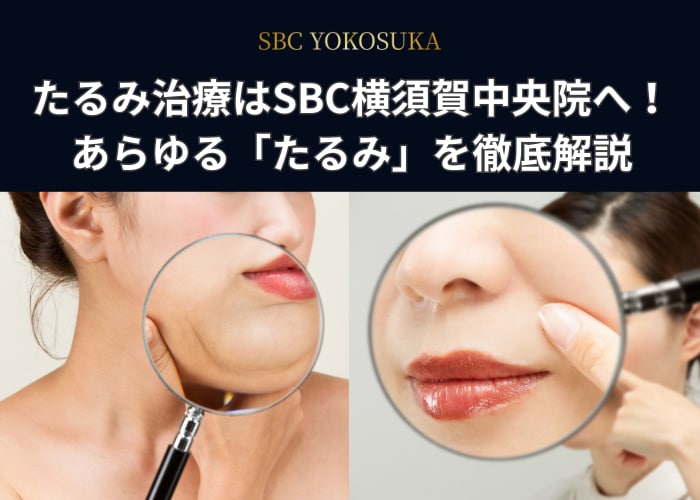 【保存版】たるみ治療はSBC横須賀中央院へ！あらゆる「たるみ」を徹底解説