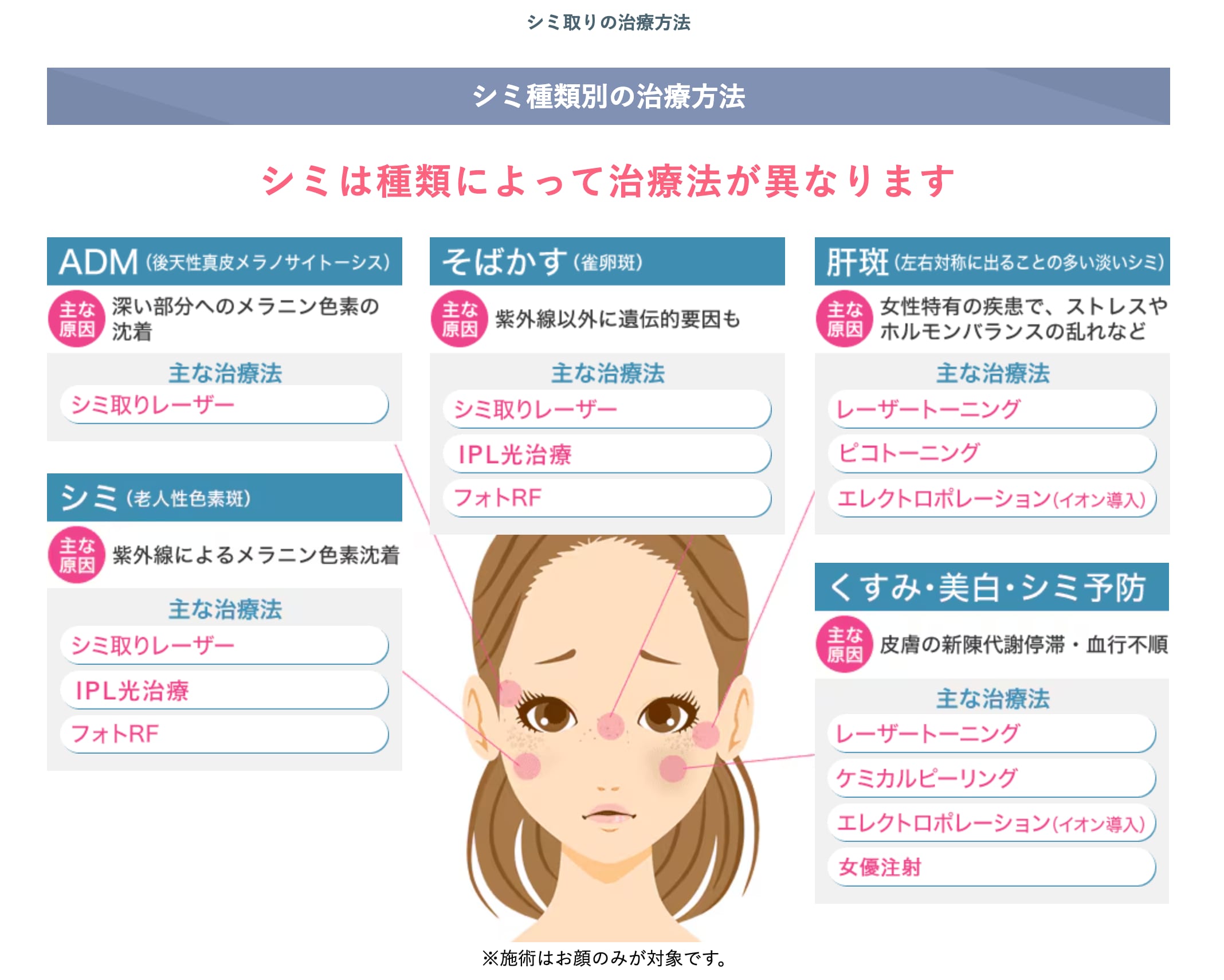 シミは、種類によって治療法が異なります！<br />
