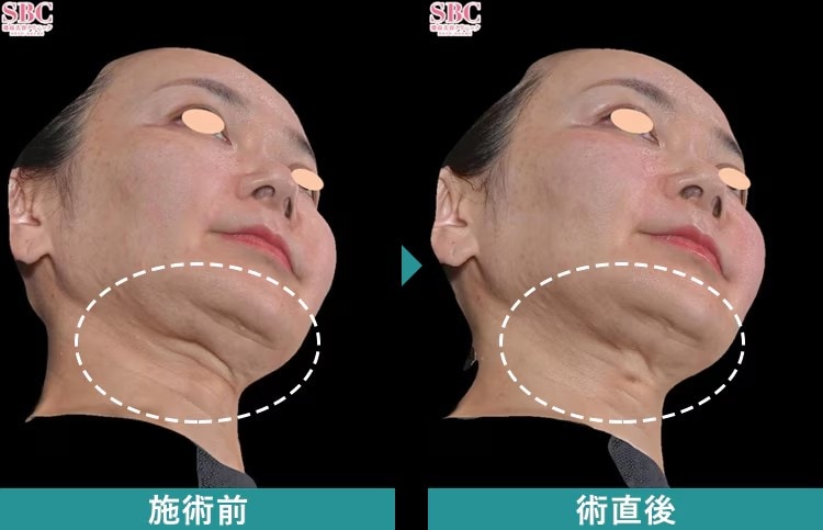 忙しい方にも嬉しい！「速攻性」と「ダウンタイムの少なさ」