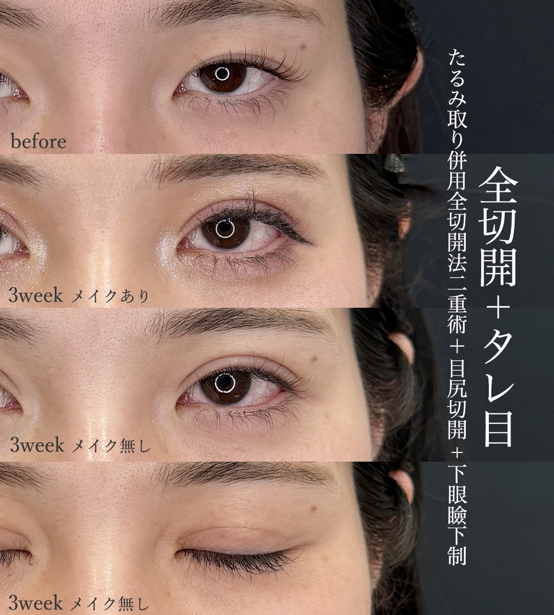 形成外科専門医の真骨頂｜「0.1mm」にこだわる精密な縫合と傷跡の美しさ