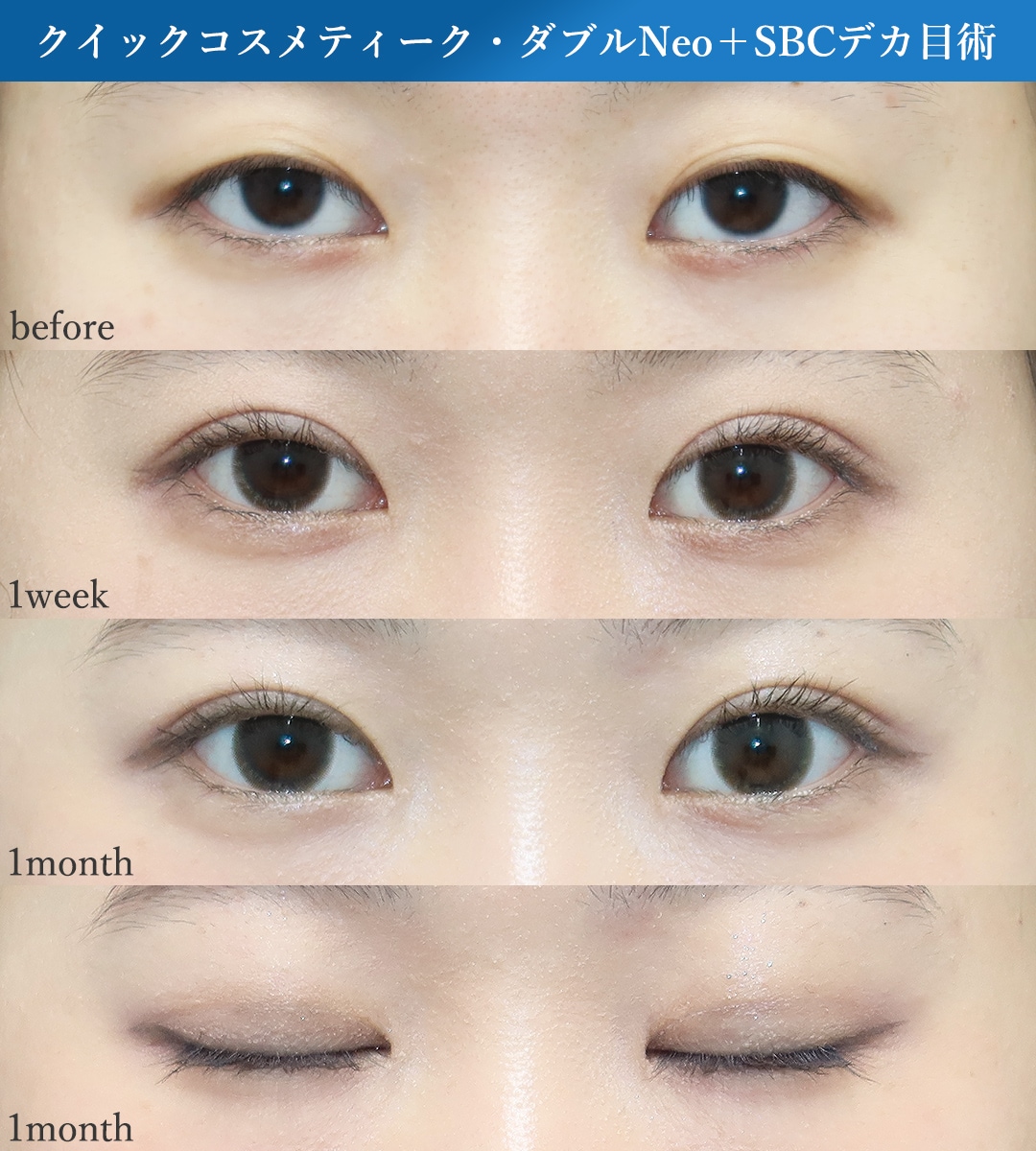 解剖学的知見に基づいた「取れにくい」固定ポイントの見極め