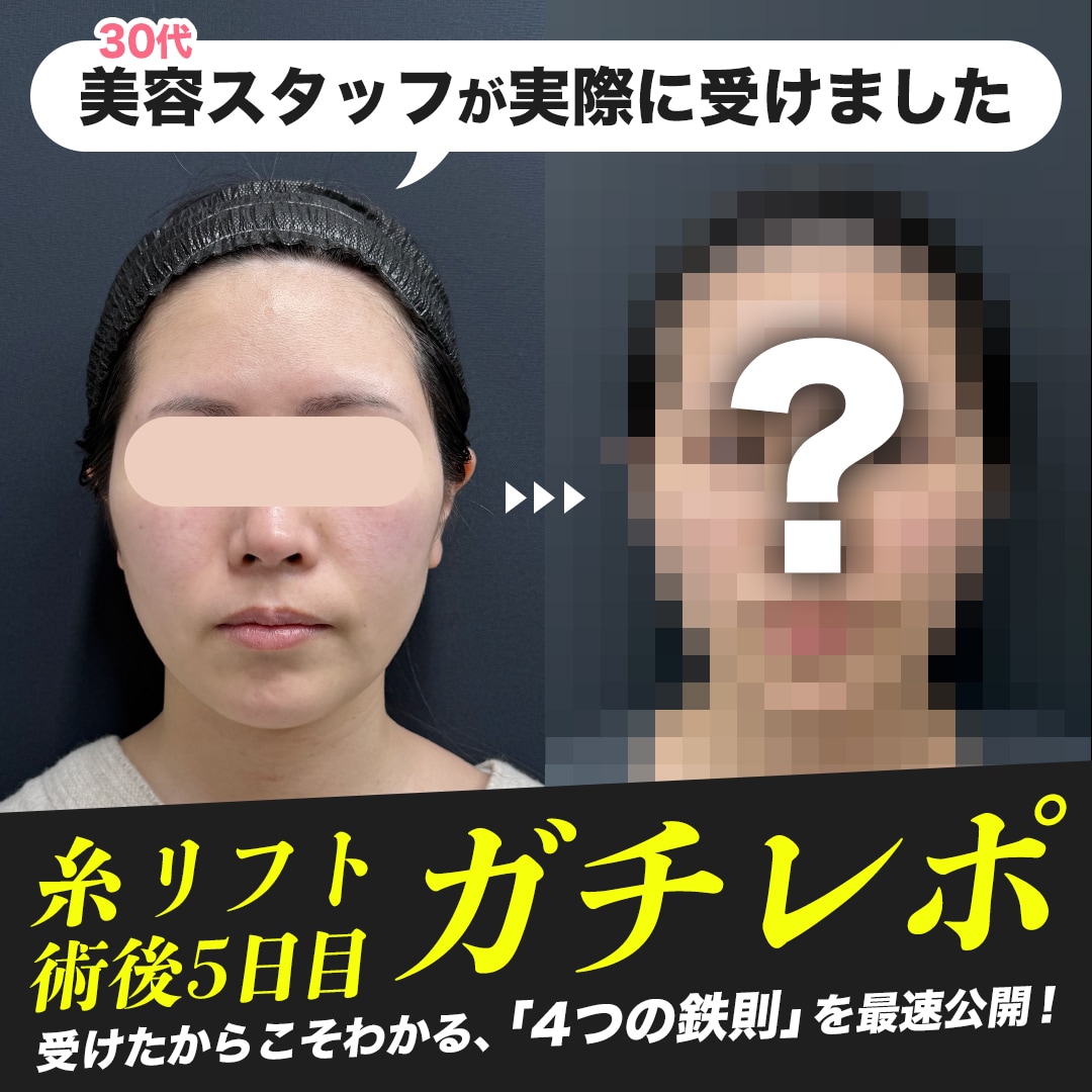 【緊急特集】糸リフト術後5日目のリアル！後悔しない為に、スタッフが今すぐ伝えたい「4つの鉄則」