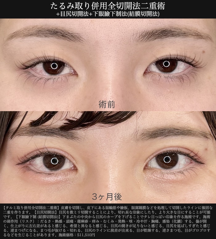 自由度の高いデザイン