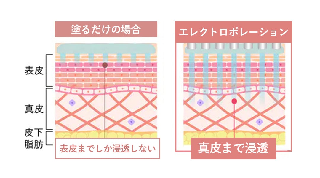 美肌マニアもイチオシの施術